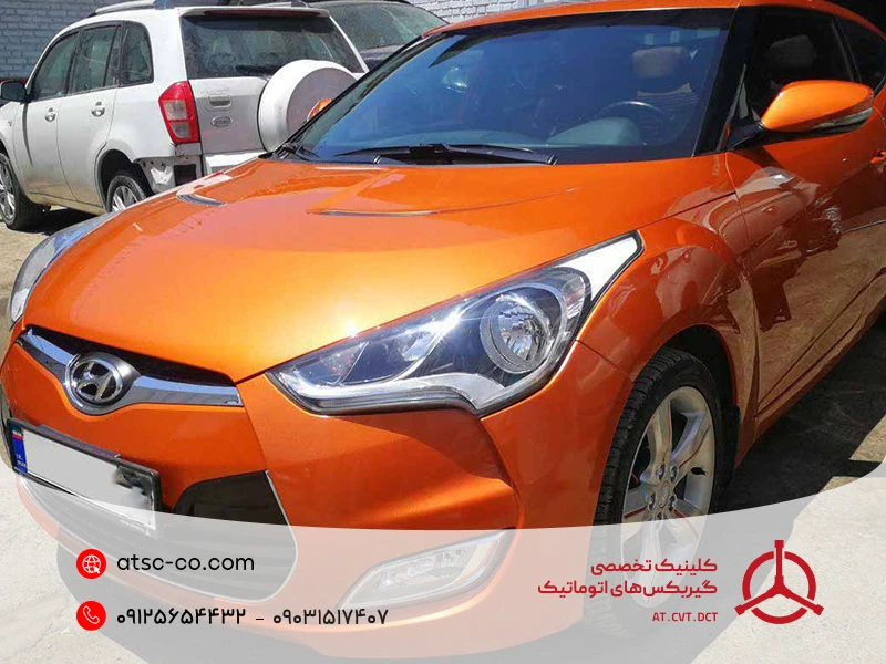 تعمیر گیربکس ولستر